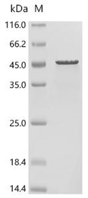 Recombinant Human Isovaleryl-CoA dehydrogenase, mitochondrial (IVD) (CSB-EP011921HU)