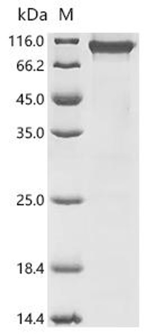 Recombinant Mouse Serine/threonine-protein kinase Nek5 (Nek5) (CSB-EP766517MO)