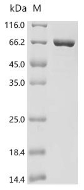 Recombinant Aquifex aeolicus Reverse gyrase 2 (rgy2), partial (CSB-EP524126DNV1)