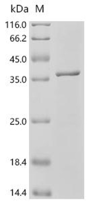 Recombinant Bordetella pertussis BrkA autotransporter (brkA), partial (CSB-EP673803BUA)
