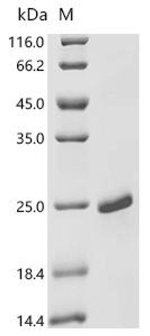 Recombinant Human papillomavirus type 53  Protein E7 (E7) (CSB-EP327601HNZ)