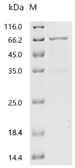 Recombinant Mouse Angiopoietin-related protein 2 (Angptl2) (CSB-EP865621MO)