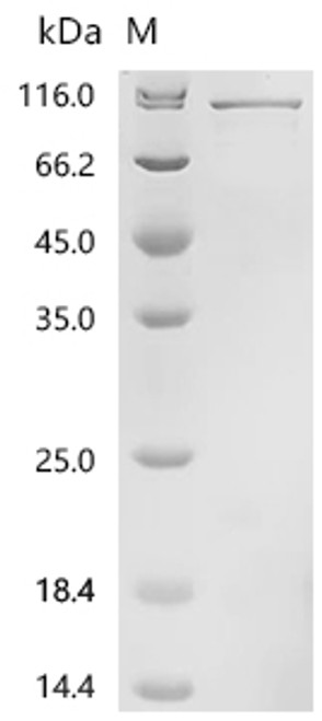 Recombinant Human Striatin-3 (STRN3) (CSB-EP614388HUd7)