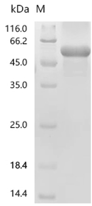Recombinant Human Immunoglobulin superfamily containing leucine-rich repeat protein (ISLR) (CSB-EP011848HU)