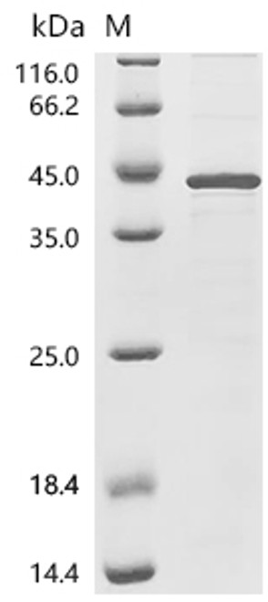 Recombinant Epstein-Barr virus Epstein-Barr nuclear antigen 6 (EBNA6), partial (CSB-EP365875EFA)