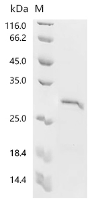 Recombinant Atrax robustus Delta-hexatoxin-Ar1a (CSB-EP355657AVGe0)