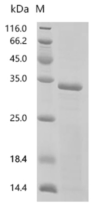 Recombinant Mouse Mucolipin-1 (Mcoln1) , partial (CSB-EP859533MO1)
