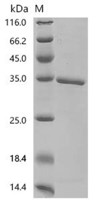 Recombinant Human Glucocorticoid receptor (NR3C1), partial (CSB-EP016059HU1c7)