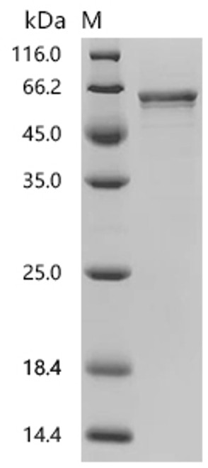Recombinant Glycine max 1-aminocyclopropane-1-carboxylate synthase (ACS1) (CSB-EP333613GGV)