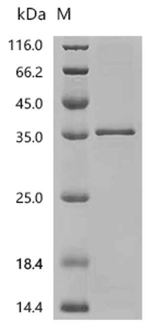 Recombinant Human F-box only protein 17 (FBXO17) (CSB-EP853409HU)