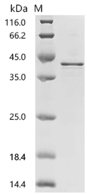 Recombinant Human Charged multivesicular body protein 4b (CHMP4B) (CSB-EP887976HUc7)