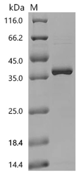 Recombinant Rat NAD-dependent protein deacylase sirtuin-5, mitochondrial (Sirt5) (CSB-EP715034RA)