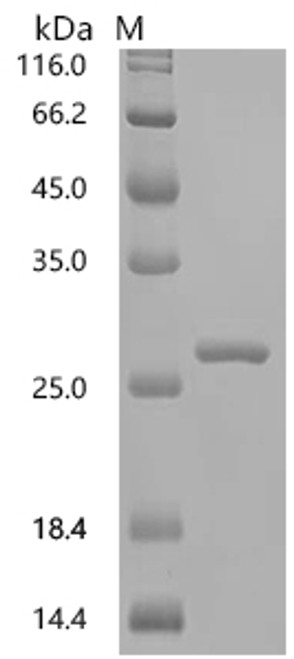 Recombinant Macaca mulatta Tumor necrosis factor (TNF) , partial (CSB-EP023955MOW)