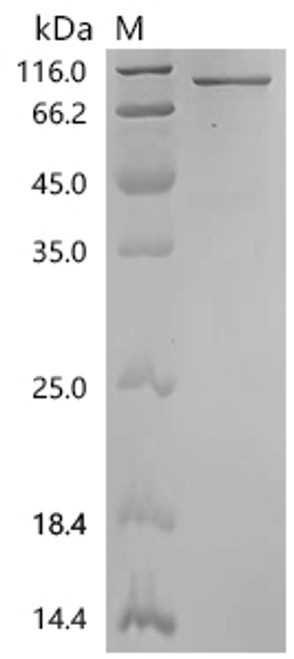 Recombinant Rat Tyrosine-protein kinase receptor TYRO3 (Tyro3), partial (CSB-EP025396RA)