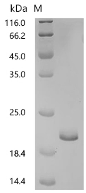 Recombinant Mouse Lutropin subunit beta (Lhb) (CSB-EP012910MO)