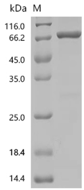 Recombinant Human GTPase HRas (HRAS), partial, Biotinylated (CSB-EP010726HU-B)