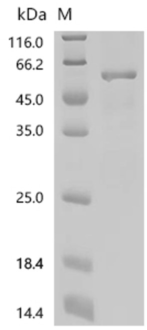 Recombinant Mouse Perilipin-2 (Plin2) (CSB-EP337564MO)