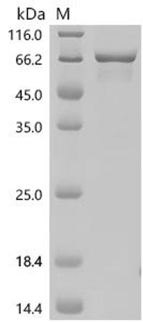Recombinant Human Forkhead box protein C1 (FOXC1) (CSB-EP618640HUc7)