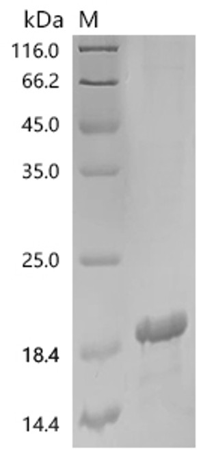 Recombinant Human Epithelial membrane protein 2 (EMP2), partial (CSB-EP007649HU1)