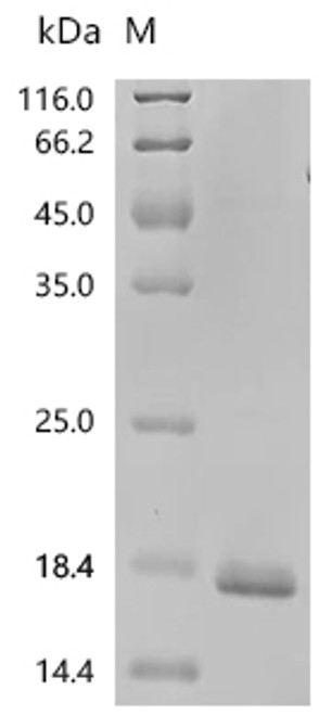 Recombinant Human Heparanase (HPSE), partial (CSB-EP010716HUc7)