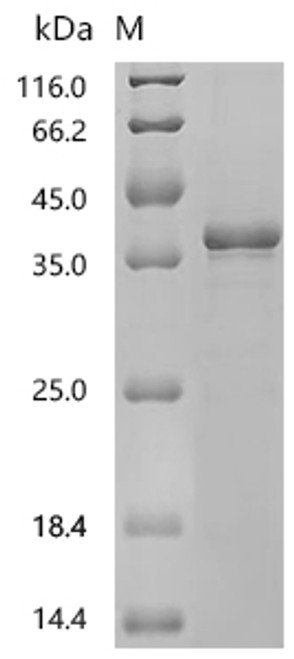 Recombinant Human Nucleoplasmin-2 (NPM2) (CSB-EP774790HU)