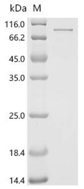 Recombinant Human ATP-dependent RNA helicase DDX3X (DDX3X) (CSB-EP006621HUc7)