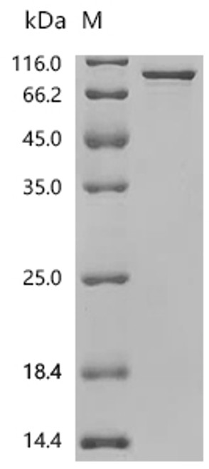 Recombinant Human ATP-dependent RNA helicase DDX3X (DDX3X) (CSB-EP006621HUd7)