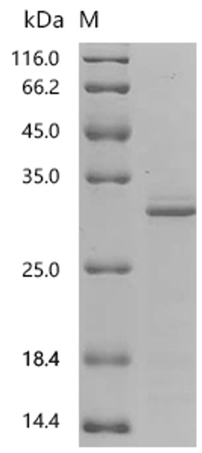 Recombinant Human Sigma non-opioid intracellular receptor 1 (SIGMAR1), partial (CSB-EP021320HUa0)
