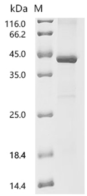 Recombinant Mouse Galectin-9 (Lgals9) (CSB-EP012895MO)