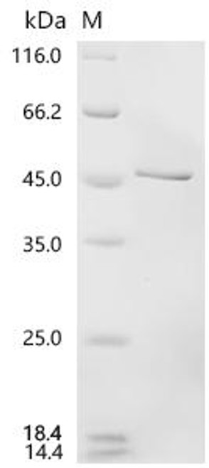Recombinant Human DDB1-and CUL4-associated factor 1 (DCAF1), partial (CSB-EP896722HU1c7)