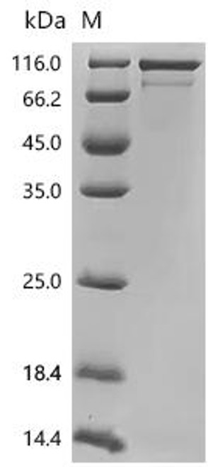 Recombinant Human GTP-binding protein GEM (GEM) (CSB-MP009362HU)