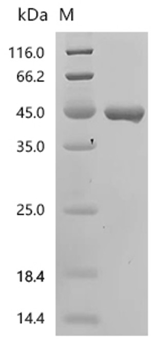 Recombinant Stenotrophomonas maltophilia Dicamba O-demethylase, oxygenase component (ddmC) (CSB-EP7065SLU)