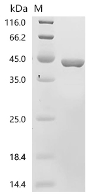 Recombinant Pig Uricase (UOX) (CSB-EP025648PIc7)