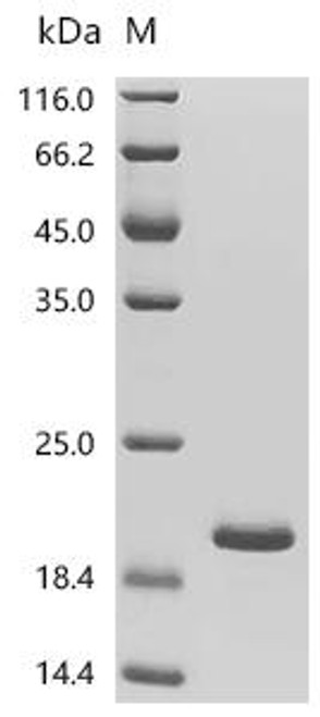 Recombinant Human Integrin alpha-M (ITGAM), partial (CSB-EP011876HUc7)