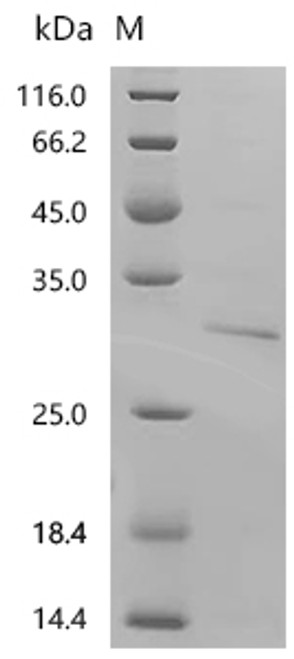 Recombinant Human GTPase KRas (KRAS) (G12C), partial (CSB-EP012493HU(F2)(M1)b0)