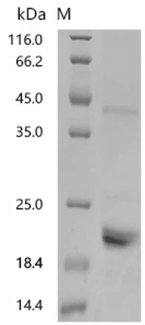 Recombinant Mouse Growth/differentiation factor 11 (Gdf11) (CSB-EP009344MO)