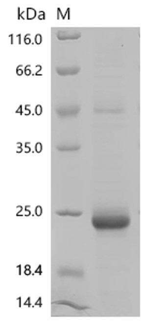Recombinant Mouse Growth/differentiation factor 9 (Gdf9) (CSB-EP009352MO)