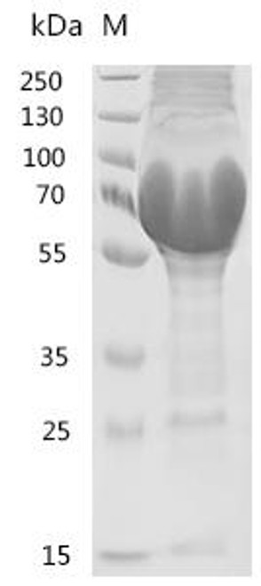 Recombinant Escherichia coli Colicin-Ia (cia) (626:I→I-GFTFSNYAMSWVRQAPGKGLEWVSSQQYNSYPYT) (CSB-EP361926ENLe1(M))