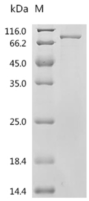 Recombinant Human NACHT, LRR and PYD domains-containing protein 3 (NLRP3) (C279A), partial (CSB-EP822275HU7(M1))