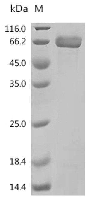 Recombinant Human Metabotropic glutamate receptor 5 (GRM5), partial (CSB-EP009935HUc7) Recombinant Human Metabotropic glutamate receptor 5 (GRM5), partial (CSB-EP009935HUc7)