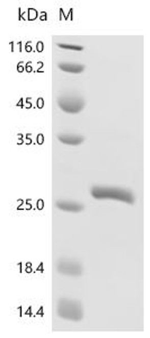 Recombinant Human GTPase KRas (KRAS) (G12C), partial (CSB-EP012493HU(F2)(M1)a0) Recombinant Human GTPase KRas (KRAS) (G12C), partial (CSB-EP012493HU(F2)(M1)a0)