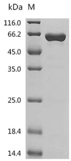Recombinant Mouse Nicotinamide phosphoribosyltransferase (Nampt) (CSB-EP015422MOa0) Recombinant Mouse Nicotinamide phosphoribosyltransferase (Nampt) (CSB-EP015422MOa0)