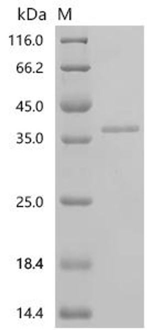 Recombinant Human Leucine-rich repeat-containing protein 9 (LRRC9), partial (CSB-EP744412HU1) Recombinant Human Leucine-rich repeat-containing protein 9 (LRRC9), partial (CSB-EP744412HU1)