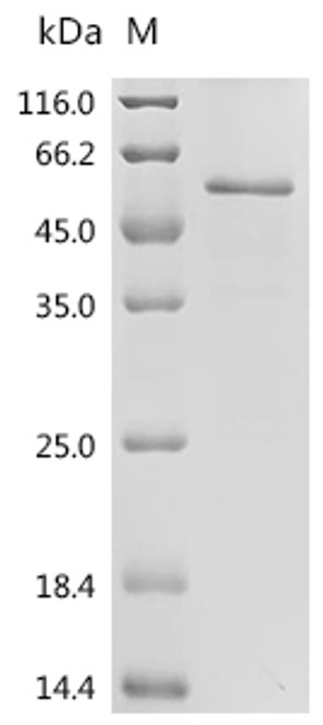 Recombinant Human Myc proto-oncogene protein (MYC) (CSB-EP015270HUe1) Recombinant Human Myc proto-oncogene protein (MYC) (CSB-EP015270HUe1)