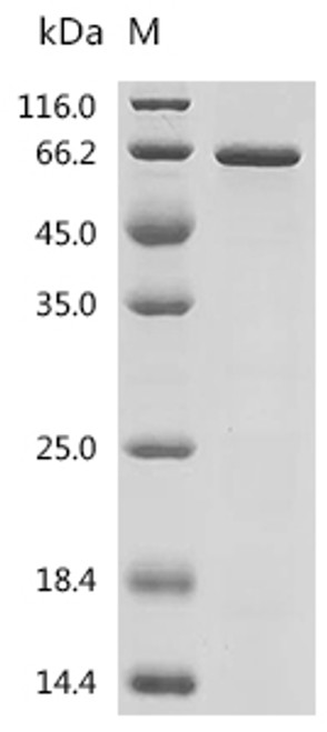 Recombinant Human Protein HEXIM1 (HEXIM1) (CSB-EP010318HU) Recombinant Human Protein HEXIM1 (HEXIM1) (CSB-EP010318HU)