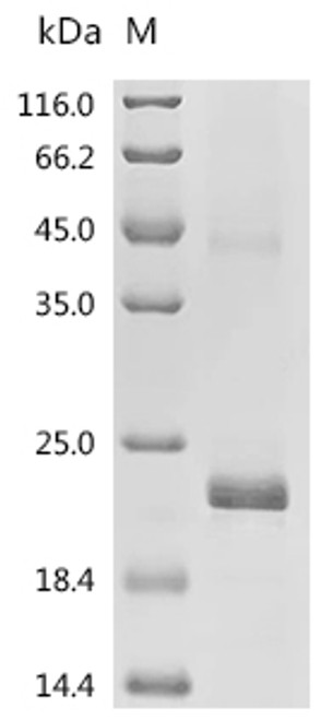 Recombinant Human Platelet-derived growth factor subunit B (PDGFB) (CSB-EP017709HUa0)