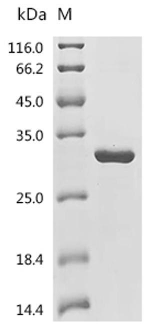 Recombinant Mouse Desert hedgehog protein (Dhh), partial (CSB-EP720251MO) Recombinant Mouse Desert hedgehog protein (Dhh), partial (CSB-EP720251MO)