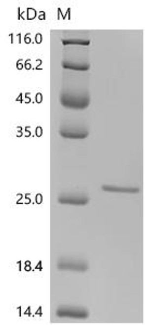 Recombinant Macaca fascicularis Usherin (USH2A), partial (CSB-EP7006MOV4)