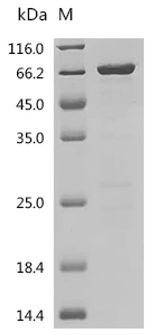 Recombinant Human GTPase KRas (KRAS) (G12C), partial, Biotinylated (CSB-EP012493HU(F2)(M1)-B) Recombinant Human GTPase KRas (KRAS) (G12C), partial, Biotinylated (CSB-EP012493HU(F2)(M1)-B)