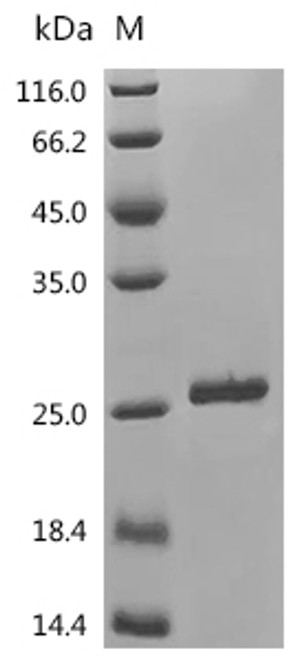 Recombinant Human Large ribosomal subunit protein eL31 (RPL31) (CSB-EP020227HU)